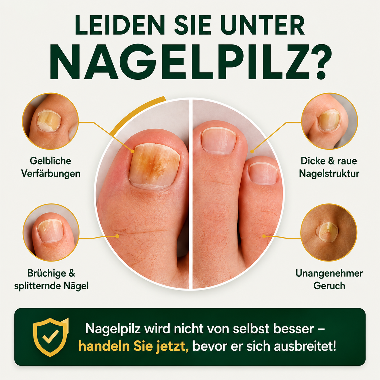 MykoCare™ – 3-in-1 Nagelpilz-Therapiegerät | Licht, Wärme & UV