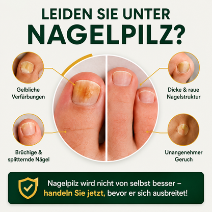 MykoCare™ – 3-in-1 Nagelpilz-Therapiegerät | Licht, Wärme & UV